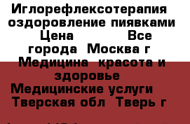 Иглорефлексотерапия, оздоровление пиявками › Цена ­ 3 000 - Все города, Москва г. Медицина, красота и здоровье » Медицинские услуги   . Тверская обл.,Тверь г.